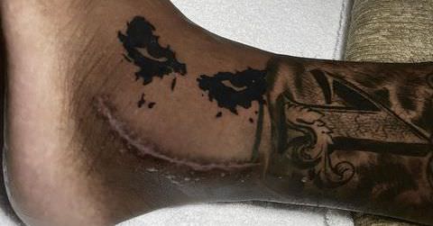 Von Miller transformou sua cicatriz no tornozelo em uma tatuagem excelente